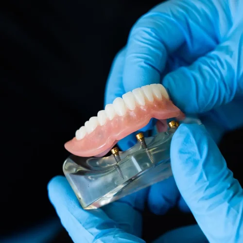 denture set__img__02